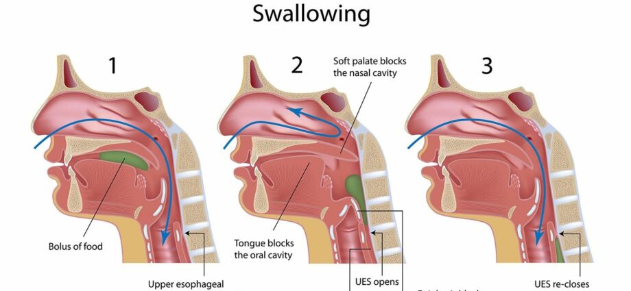 Difficulty swallowing