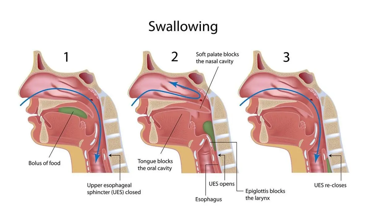 Difficulty swallowing