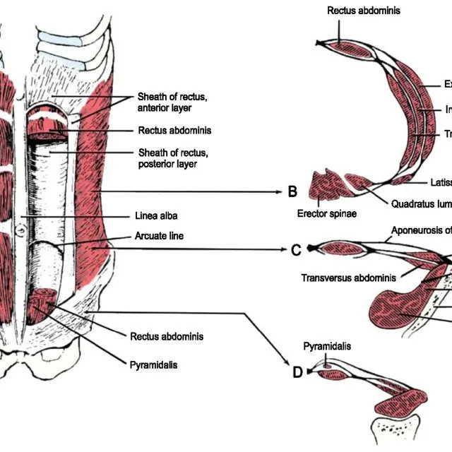 Discrepancy of the rectus abdominis muscles during pregnancy