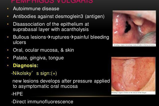 Diseases of the oral cavity: how to deal with them?