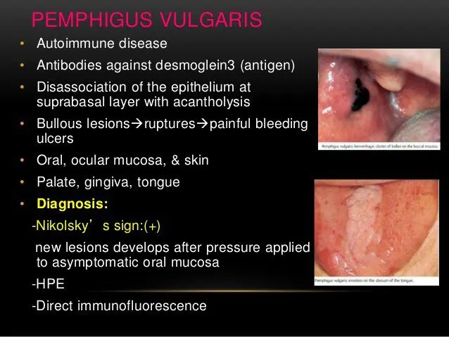 Diseases of the oral cavity: how to deal with them?