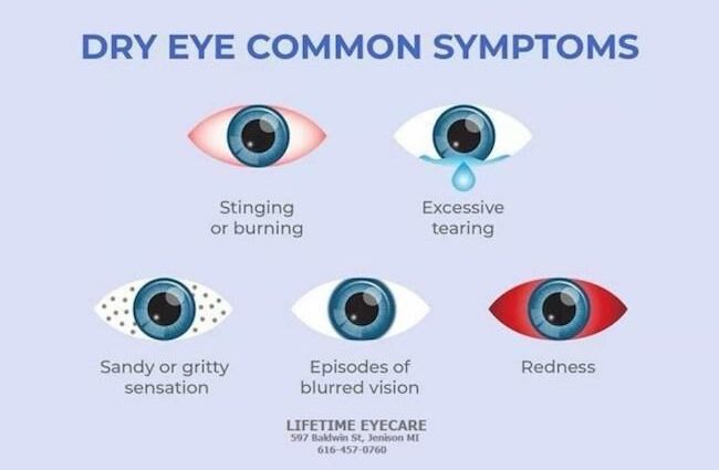 Dry eye syndrome &#8211; how to treat