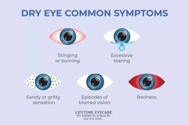 Dry eye syndrome &#8211; how to treat