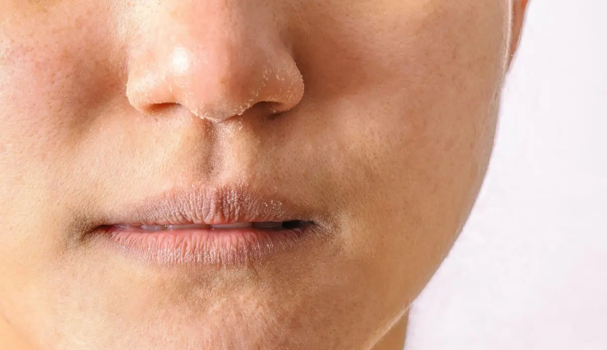 Dry skin: what to do when you have dry skin?