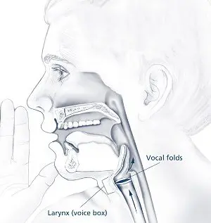 Dysphonia: all you need to know about this voice disorder