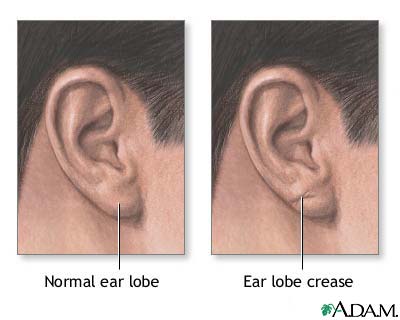 Ear lobe