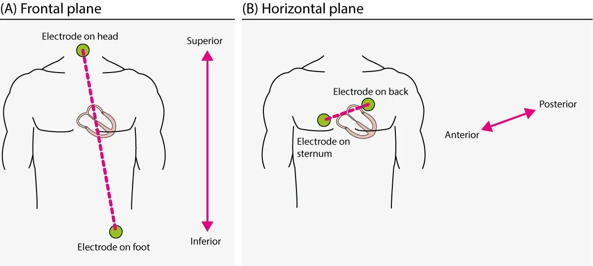 ECG electrodes: definition, role, use