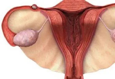 Ectopic and regular pregnancy after laparoscopy