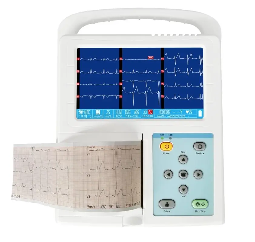 Electrocardiograph: what is this medical instrument for?