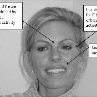 Emotionally psychological state depends on botox