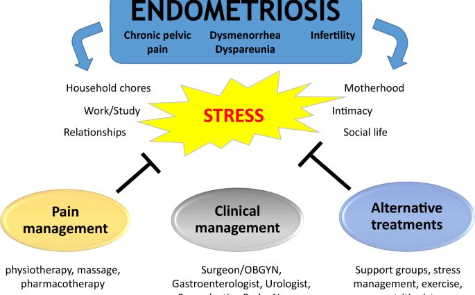 Endometriosis - usoro nkwado