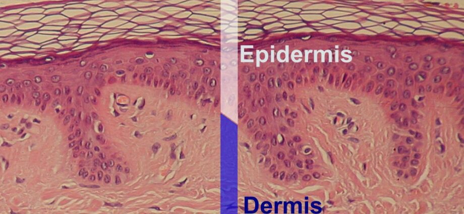 Epidermis