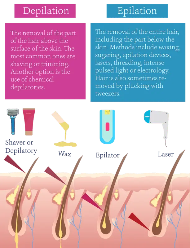 Epilation types: pros and cons