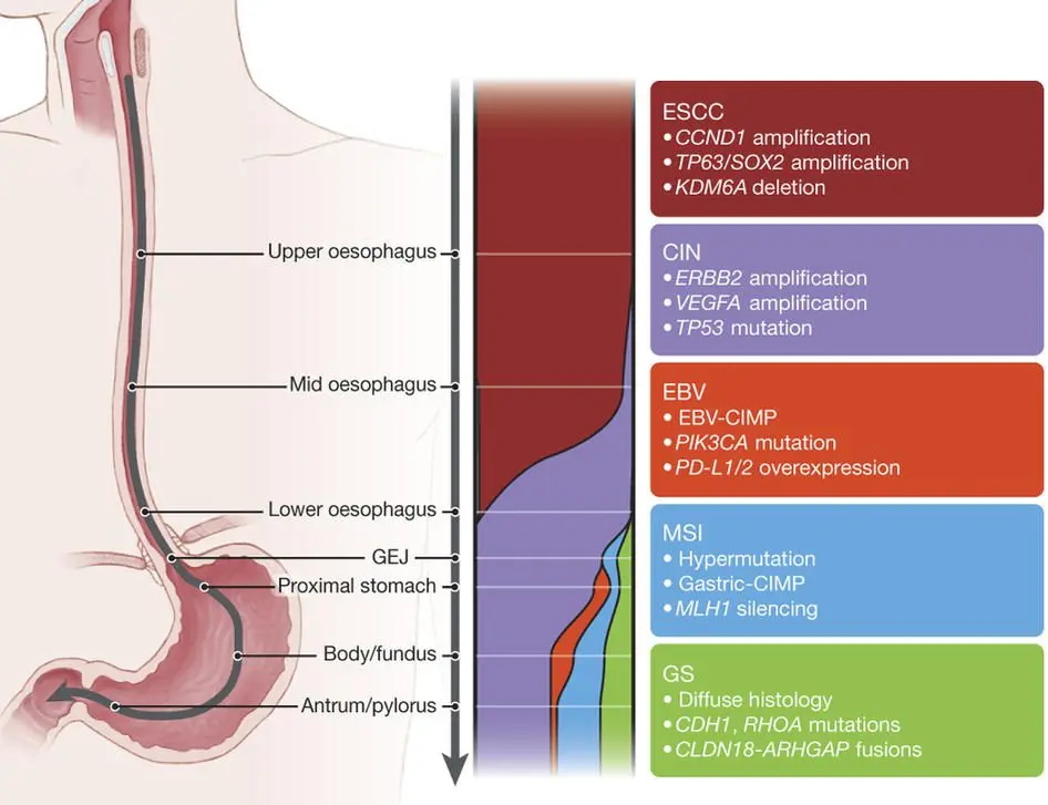 Esophageal cancer interest sites, support groups and references