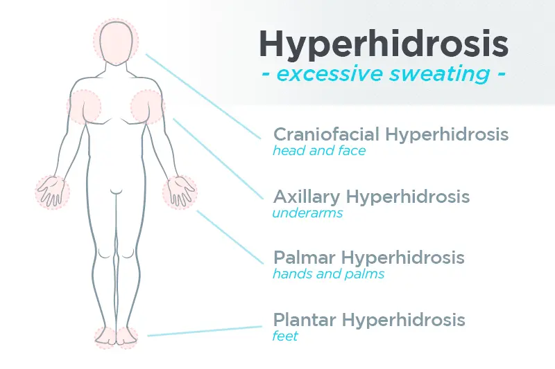 Excessive sweating: how to treat