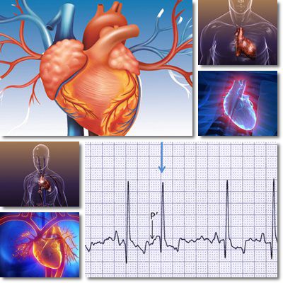 Extrasystole: causes, symptoms and treatments