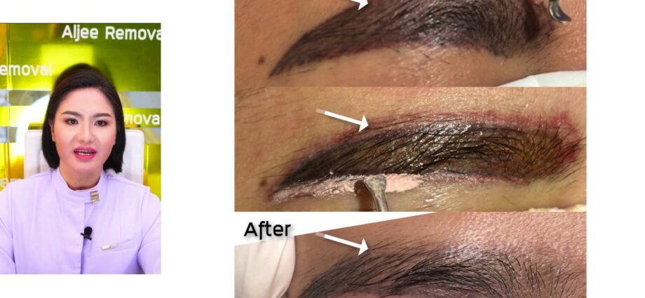 Eyebrow tattoo: how to remove marks? Video