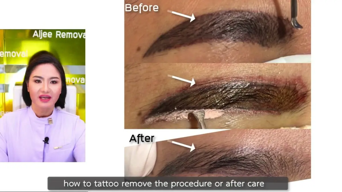 Eyebrow tattoo: how to remove marks? Video