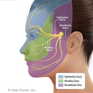 ألم العصب الوجهي (مثلث التوائم) - مواقع الاهتمام