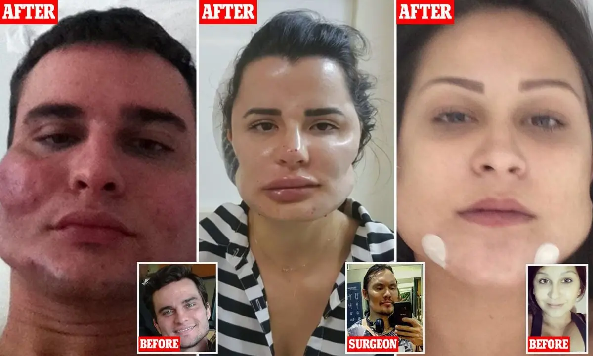 Failed cosmetic surgery: what recourse?