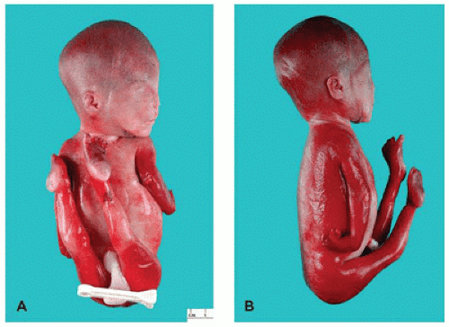 Anormalità fetali