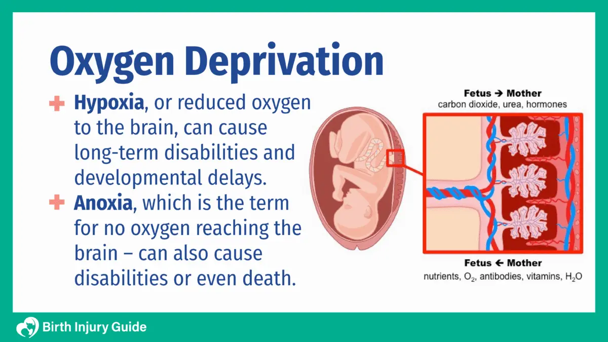 Fetal hypoxia: how to define oxygen deprivation? Video