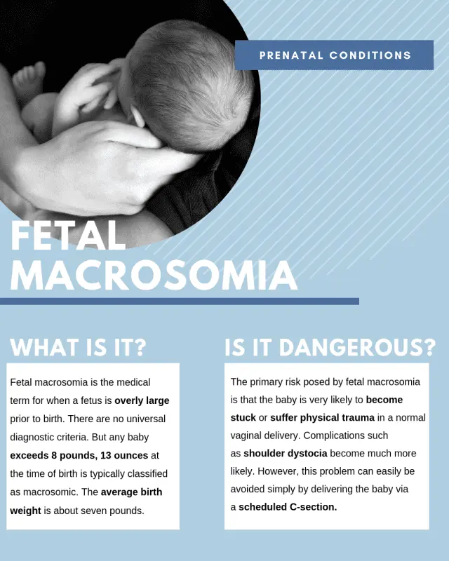 Fetal macrosomia: when you are expecting a big baby