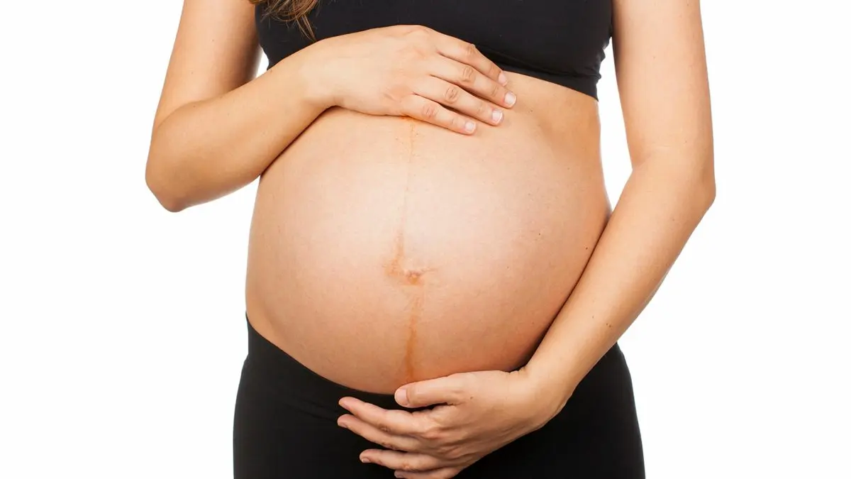 Find the line after pregnancy: how to do?