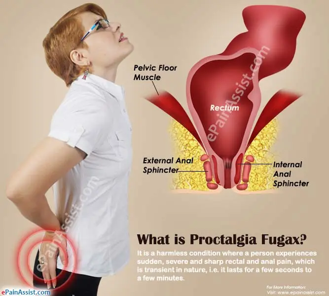 Fleeting proctalgia