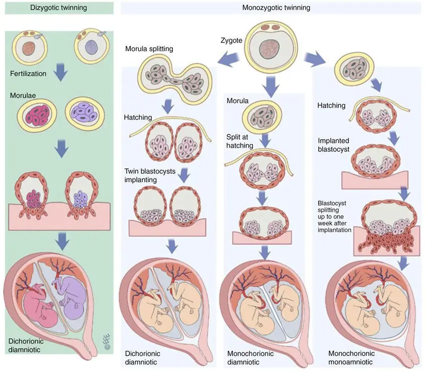 Fraternal twins: what are dizygotic twins?