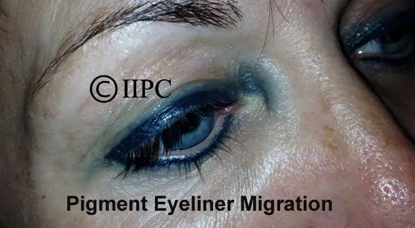 Frequent mistakes in permanent makeup: expert opinion