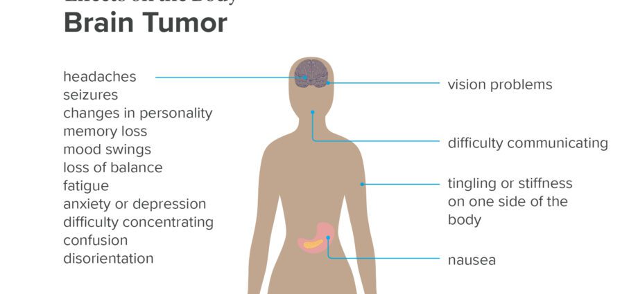 From anxiety to brain tumors: causes and treatments for vertigo