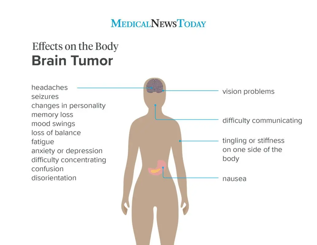 From anxiety to brain tumors: causes and treatments for vertigo