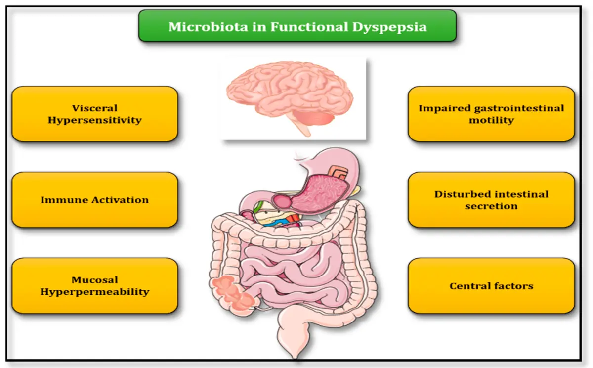 Functional digestive disorders (dyspepsia) &#8211; Sites of interest