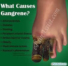 Gangrene, what is it?