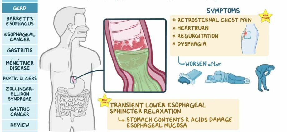 Gastritis, ulcer, stomach cancer: symptoms, treatment