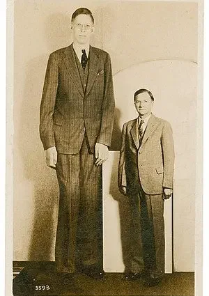 Gigantism