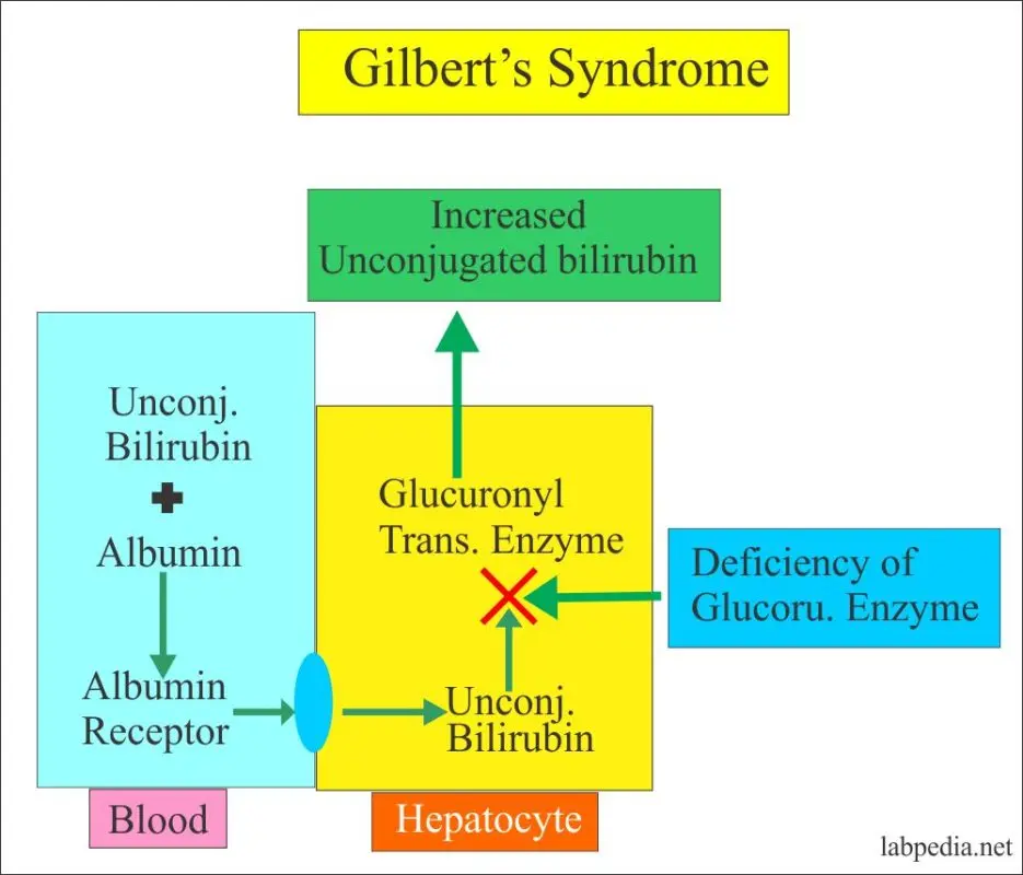 Gilbert&#8217;s disease, what is it?