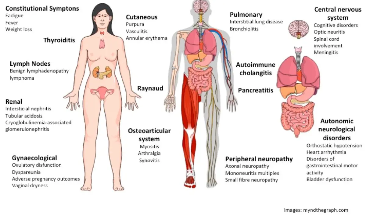 Gougerot-Sjögren syndrome: complementary approaches