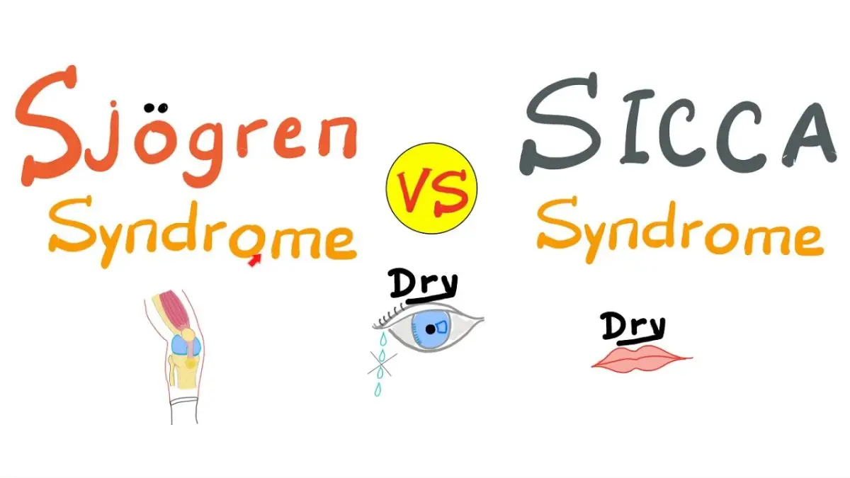 Gougerot-Sjögren syndrome (sicca syndrome)