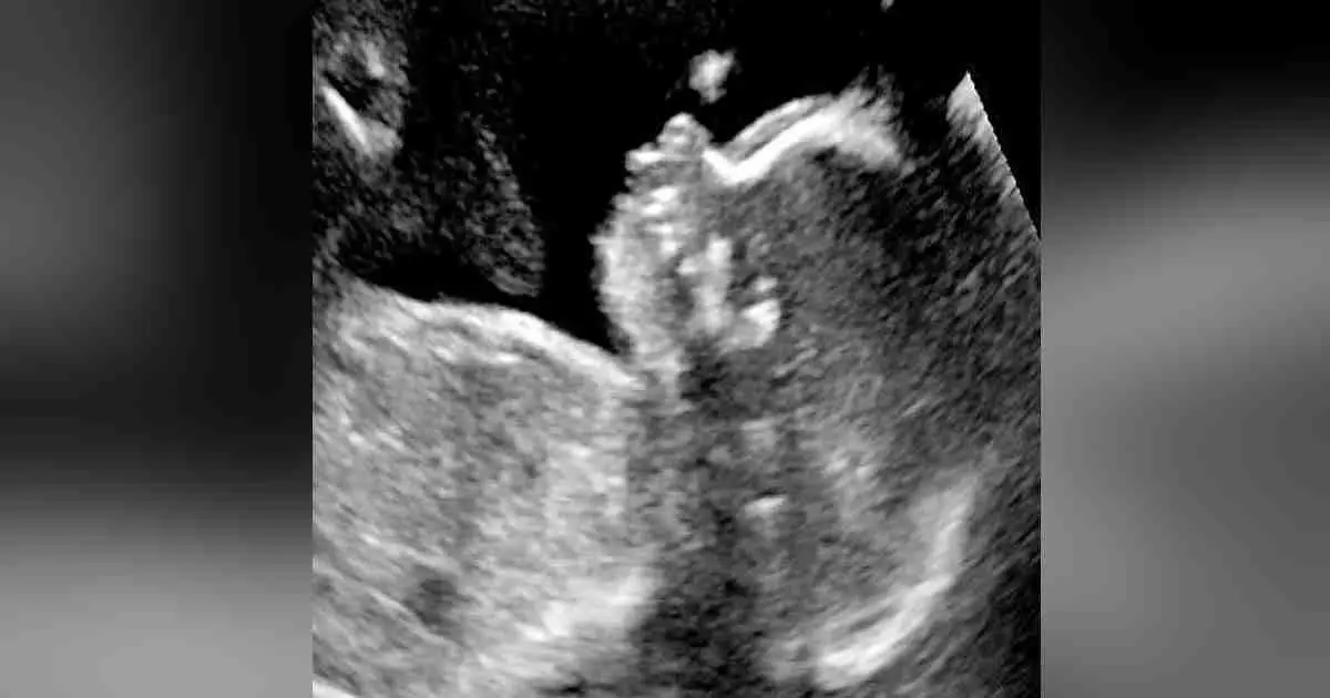 Growing in the womb and visible on ultrasound: 10 facts about children&#8217;s hair