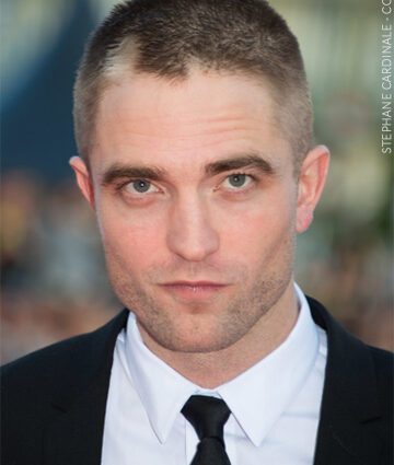 Izpadanje las na glavi Roberta Pattinsona
