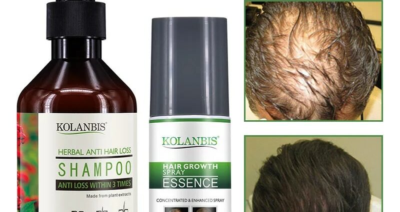 Hair loss: our anti hair loss solutions and treatments