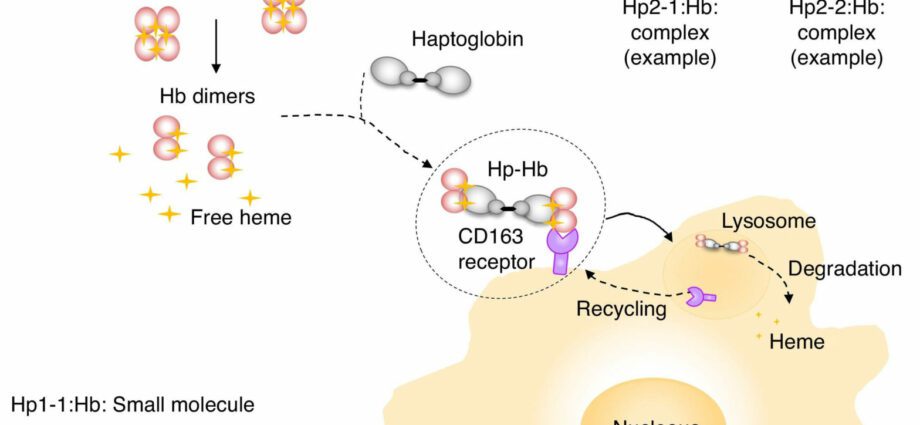 Haptoglobin: when to test?