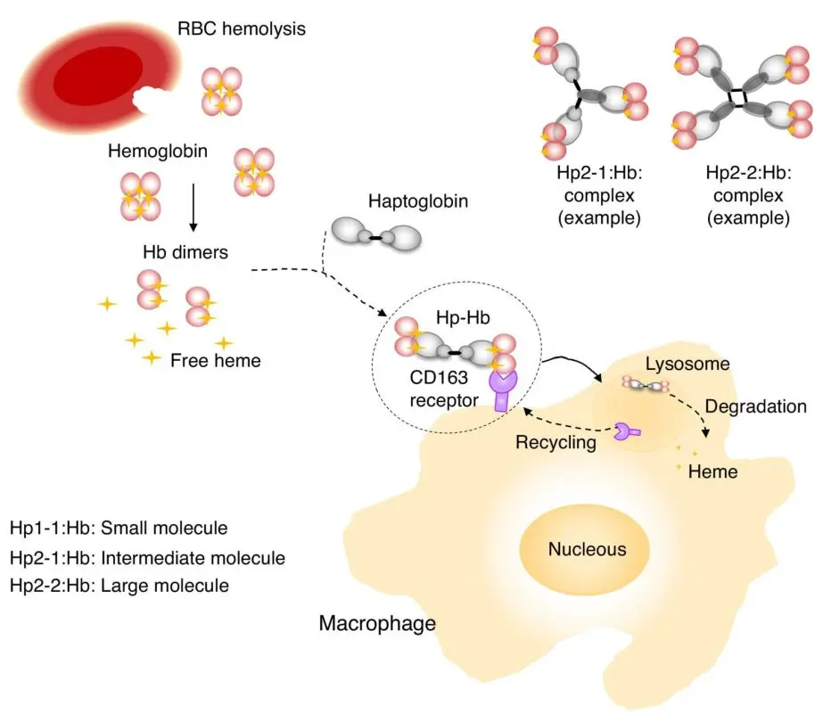 Haptoglobin: when to test?