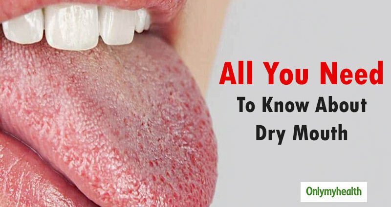 Have a dry mouth: what to do in case of xerostomia?