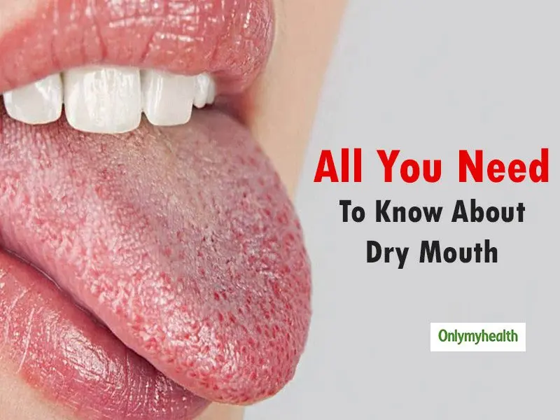 Have a dry mouth: what to do in case of xerostomia?