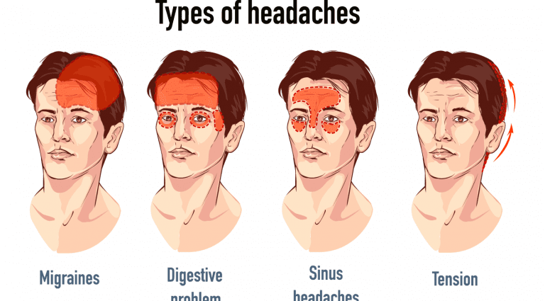Bolesti hlavy