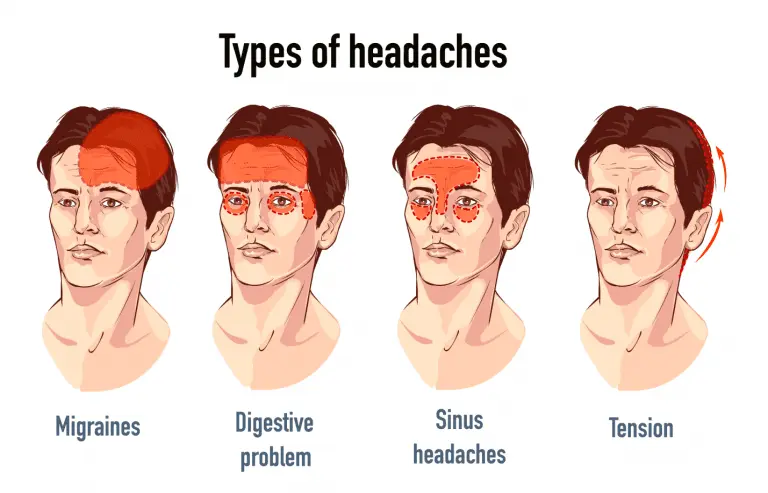 Headaches: causes and treatment