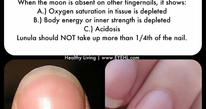 Healthy nails &#8211; a healthy body